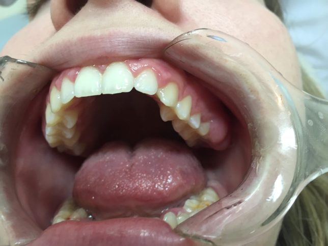 dental checkup